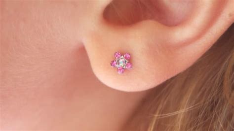 Piercing Infection - Local Infection With Granuloma After Helix Piercing Result One Week ...