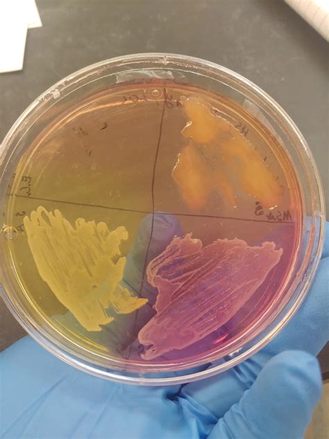 an MSA plate i grew we 4 differ streaks! -more info in comments! : r/microbiology