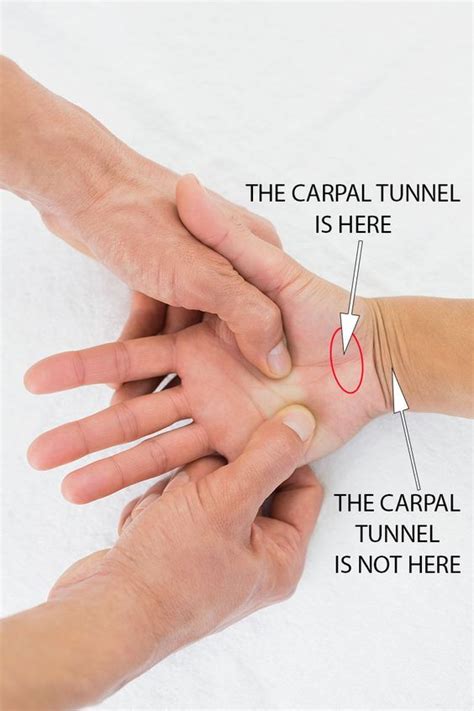 Pin by Patricia Bosworth on accupressure | Carpal tunnel, Carpal tunnel remedies, Carpal tunnel ...