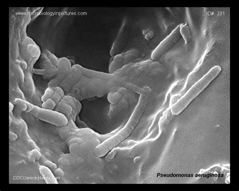 Pseudomonas aeruginosa SEM micrograph. Appearance of Pseudomonas aeruginosa and cell morphology ...