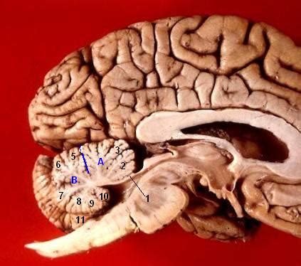 File:Human brain midsagittal view description.JPG - Wikimedia Commons