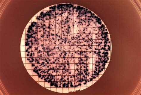 Kostenlose Bild: Mikrophotographie, Kolonie, Neisseria, gonorrhoeae, Bakterien, Zelle ...
