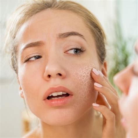 Does Dry Skin Cause Wrinkles? - Skin Elite