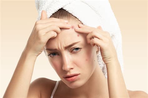 Acne & Blemishes Removal Treatments | ecosmetic | Calgary