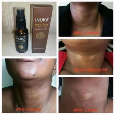 Inuka skin clearing oil and... - Inuka fragrances by Sophie