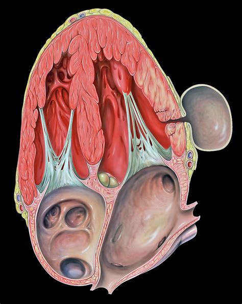 Difference Between True and False Aneurysm | Compare the Difference Between Similar Terms