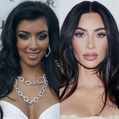 Kim kardashian before and after | Celebrity surgery, Celebrity plastic ...