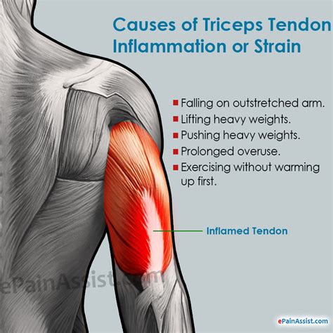 DERİN TENDON REFLEKSLERİ(DTR)