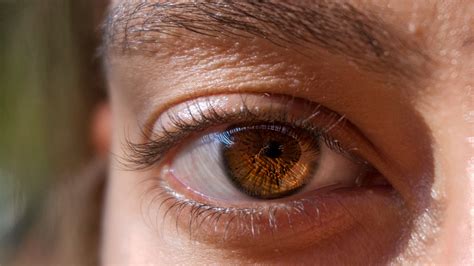 Hypertensive Retinopathy: Symptoms, Causes, and Treatments