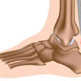 Insertional Achilles Tendonitis - Symptoms, Causes, Treatment & Rehab