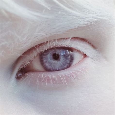 albino violet eyes - Google Search | Beautiful eyes, Pretty eyes, Aesthetic eyes