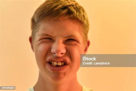 Close Up Portrait Of Joyful Disabled Boy With Down Syndrome Making Funny Faces While Posing ...