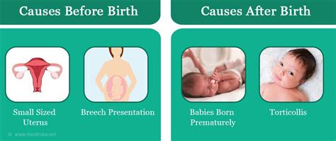 Plagiocephaly - Types, Causes, Symptoms, Complications, Diagnosis ...