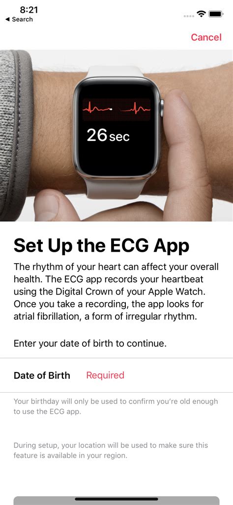 ECG is now available on the Apple Watch in SG and here’s what you need ...