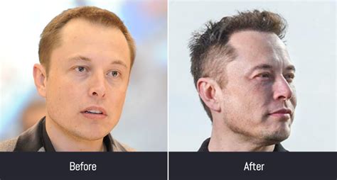 How Did Elon Musk Fix His Hair | Best Fashionable Items