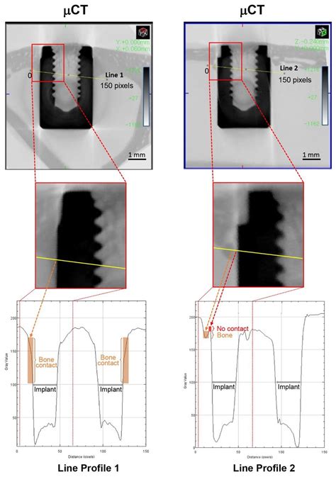 High detection resolution of micro CT. µCT images of the same specimen... | Download Scientific ...