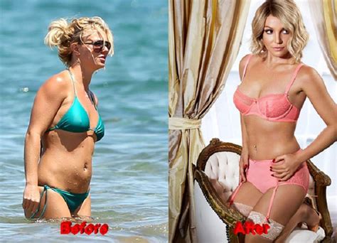 Britney Spears Before and After Plastic Surgery Reveals Her Popstar Journey