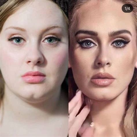 Adele (Before & After) | Adele, Adele before, Adele before and after