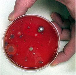 Petri Dish Bacteria Growth