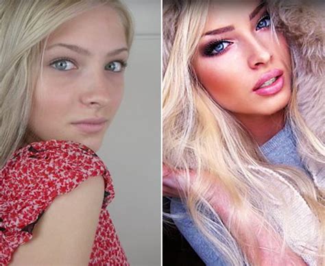 Shocking Pictures Of Instagram Models Before Plastic Surgery Top | My ...