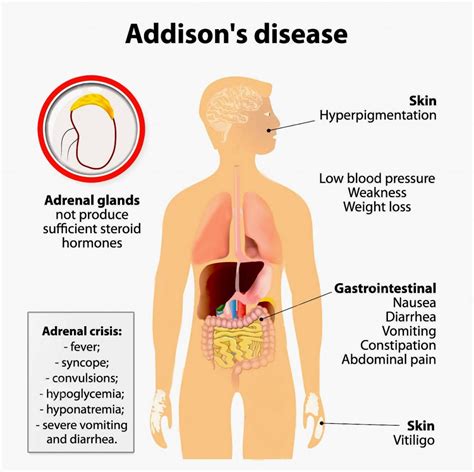 Adrenal glands (the emergency glands) - Online Science Notes