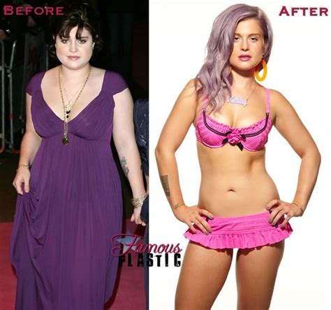 jels — Kelly Osbourne before and after losing 69lbs | We Know How To Do It