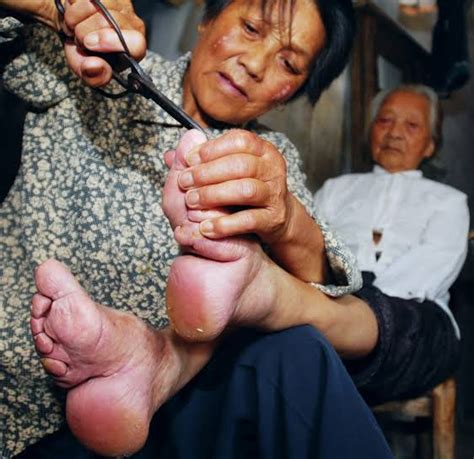 Wat presies is Chinese voetbinding?