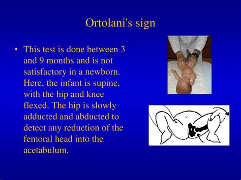 PPT - Develompmental Dysplasia of the Hip (DDH) . PowerPoint Presentation - ID:3701351