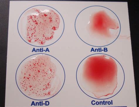 Blood Evidence | Create WebQuest