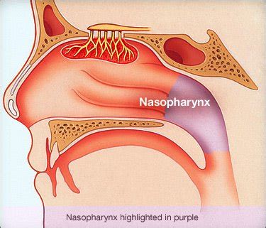 Types of nasopharyngeal cancer | Vinmec