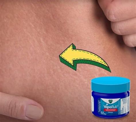 8 Unexpected Uses Of Vicks VapoRub