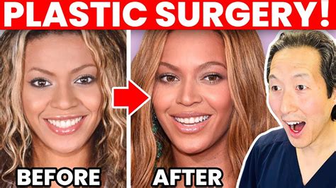 BEYONCÉ Plastic Surgery Transformation – Cosmetic Surgeon Reacts ...