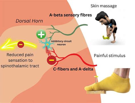 illustration of the Melzack and Wall gate control theory: nonpainful ...