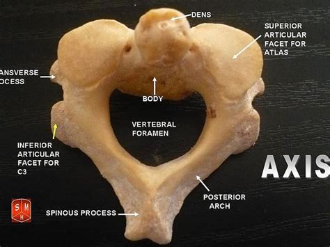 What is the Difference Between Atlas and Axis Vertebrae - Pediaa.Com | Axis vertebra, Vertebrae ...