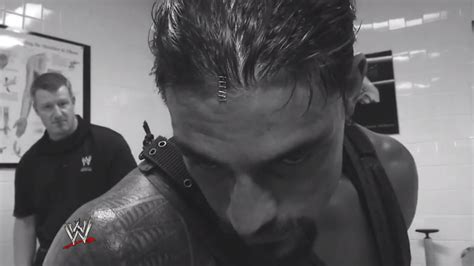 Roman Reigns injured on Raw; watch video of him getting staples put into his head - Cageside Seats