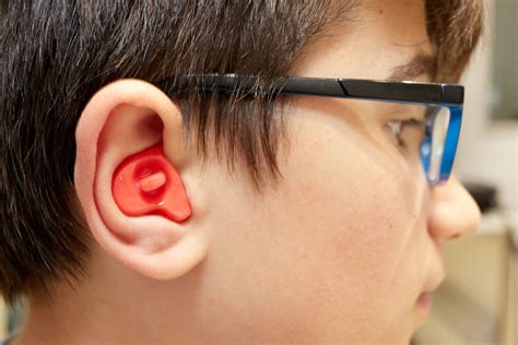 Custom Ear Molds | Pinehurst Surgical Clinic