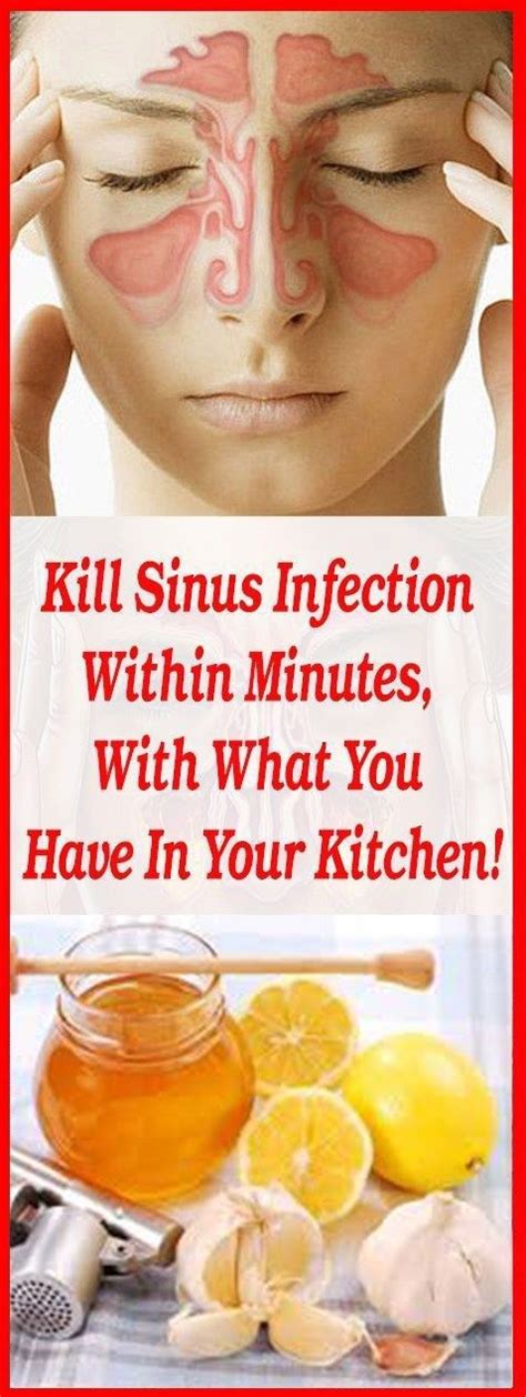 Can Antihistamines Cause Sinus Infections