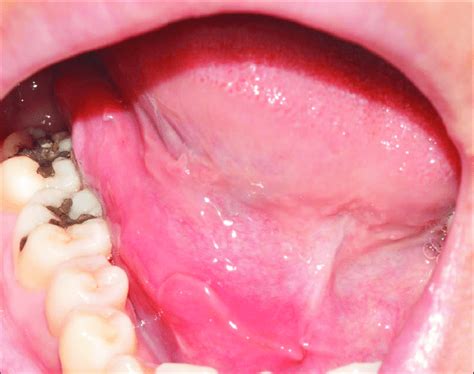 Preoperative intraoral clinical photograph. Seung-Kee Shim et al ...