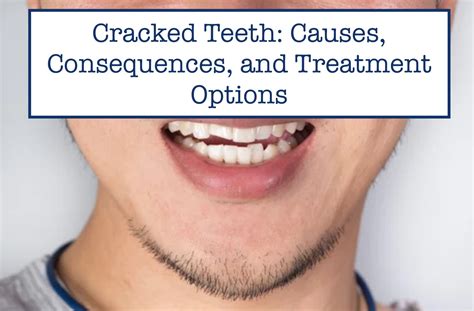 Cracked Teeth: Causes, Consequences, and Treatment Options