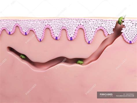 Scabies mites burrowing into the skin — cross section, parasite - Stock Photo | #160229062
