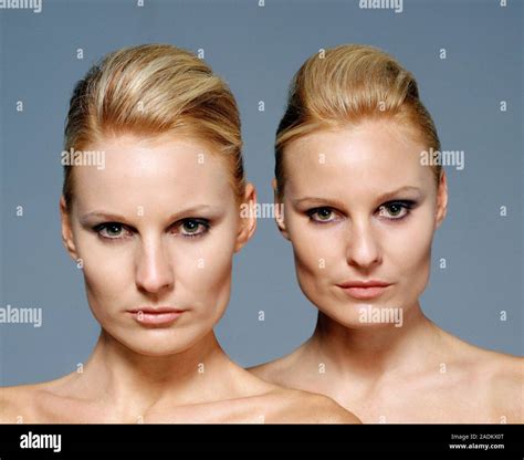 MODEL RELEASED. Identical twin sisters. Genetically identical ...