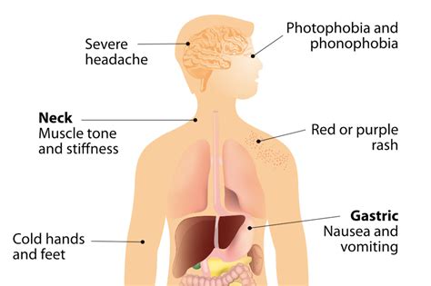 What is meningococcal disease and what are the options for vaccination?