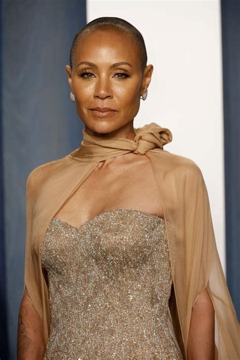 Celebrities with alopecia: 6 famous faces with hair loss