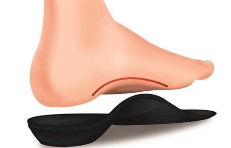 What Are The Benefits Of Custom Orthotics - Wellness-Info