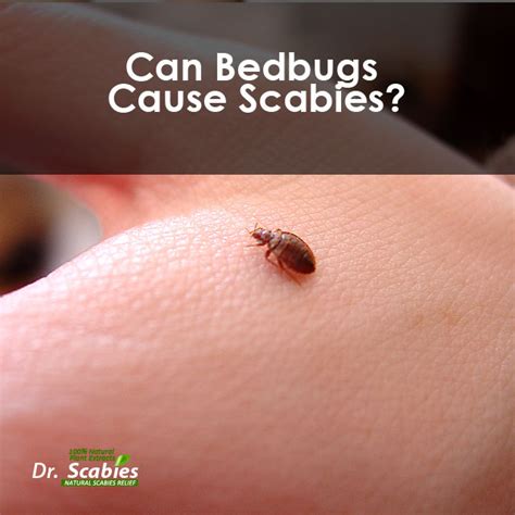 Scabies: A Skin Condition Caused By Itch Mites – FutonAdvisors