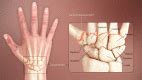Anatomy, Shoulder and Upper Limb, Hand Carpal Bones - StatPearls - NCBI ...
