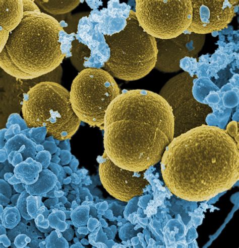 Staphylococcus aureus - Wikipedia, la enciclopedia libre