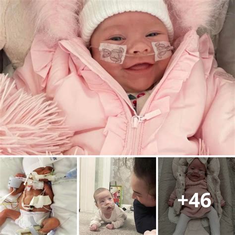 An Unprecedented Journey: Welcoming a Premature Baby 14 Weeks Early, No ...