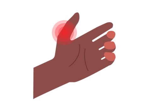How To Reduce Swelling In Thumb - Forcesurgery24