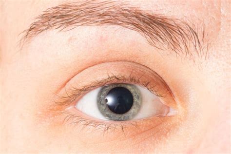 Mydriasis (Pupil Dilation): Causes, Treatment and More | MyVision.org